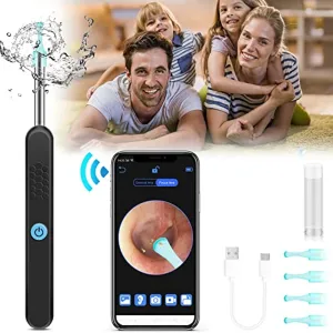 Ear Cleaning Ear Wax Removal Camera Tool, Ear Cleaning kit Smart Visual Ear Cleaner, 1296P Wireless Ear Otoscope, Ear Scope with Ear Wax Cleaner Tool for Babies Kids Adults Pets